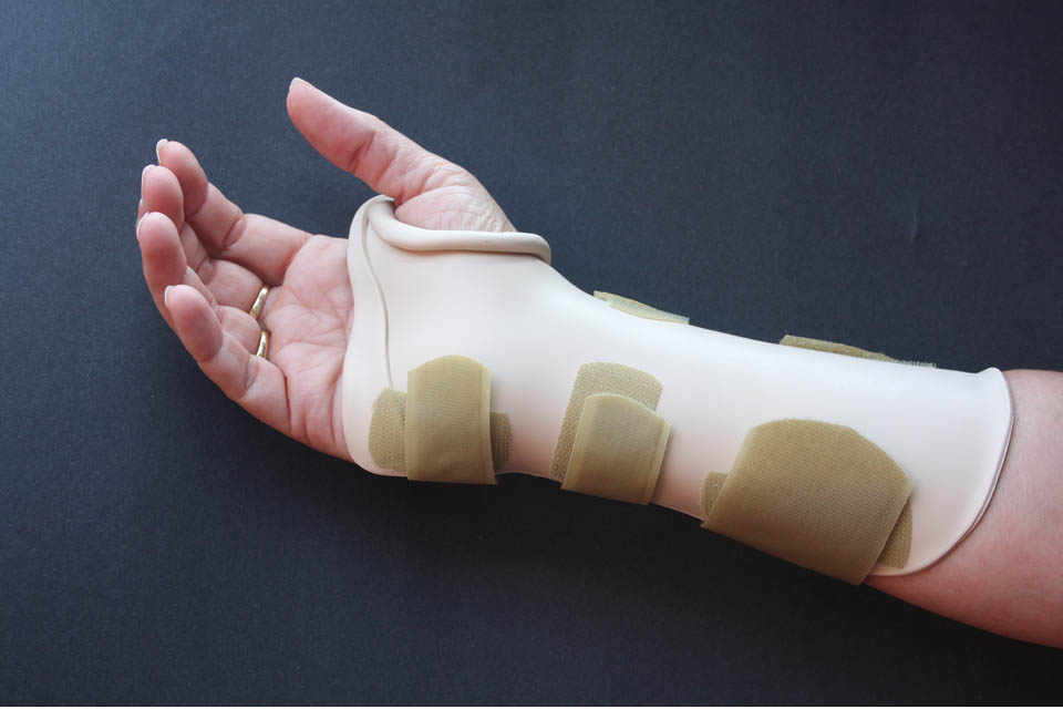 Custom Thermoplastic Splints - Hamilton, Halton, Niagara - Hand Network